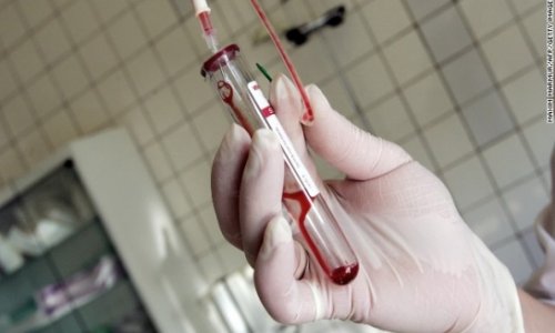 Second baby possibly 'cured' of HIV