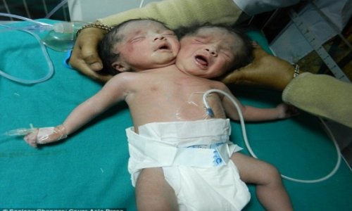 The baby with two heads - PHOTO+VIDEO