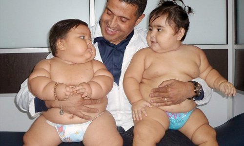 Obese duo sent for special treatment in Colombia - PHOTO