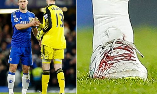 Ivanovic's bloodied boot should go straight to the academy