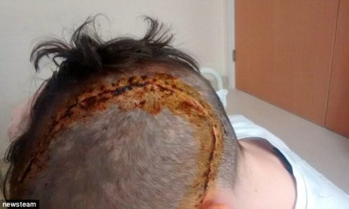 Horrific injuries of 16-year-old boy