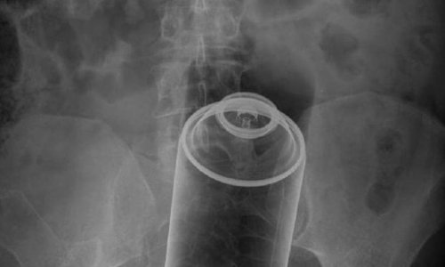 Most unusual X-rays