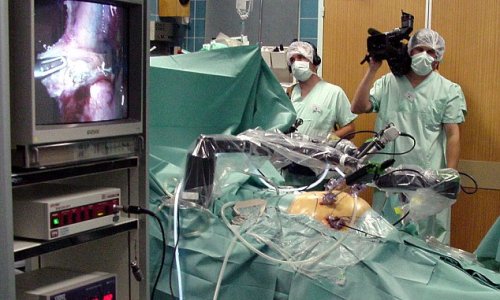 Google to develop robo-surgeons