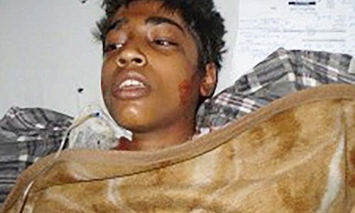 Muslim youths attack child and set him on fire in Pakistan because he is a Christian