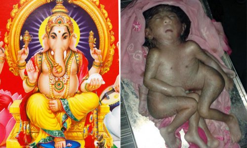 Baby born with EIGHT limbs worshipped as 'Hindu God'