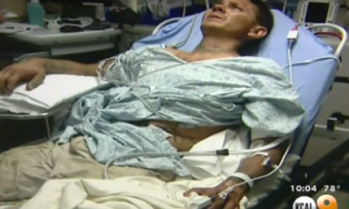 Американец попал в больницу после селфи с гремучей змеей