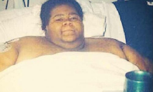 World's fattest woman who was bed-bound for FIVE YEARS