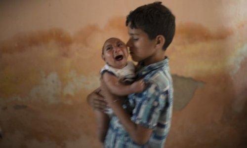 Zika virus: Study supports link to microcephaly