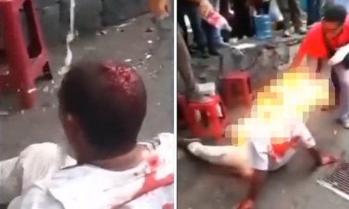 Vigilante mob burn man alive in street in world's most dangerous city