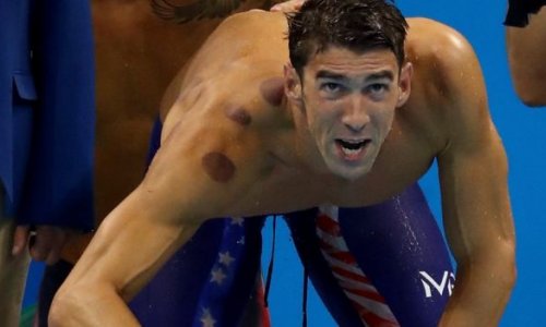 Why are so many Olympians covered in large red circles?