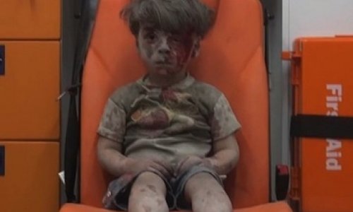 Little boy in Aleppo a vivid reminder of war`s horror