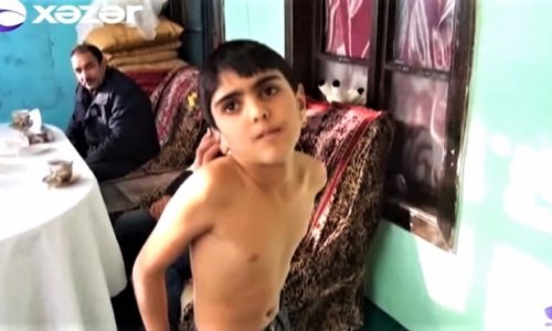 9 yaşlı uşaq qeyri-adi hərəkətləri ilə diqqət çəkir - VİDEO