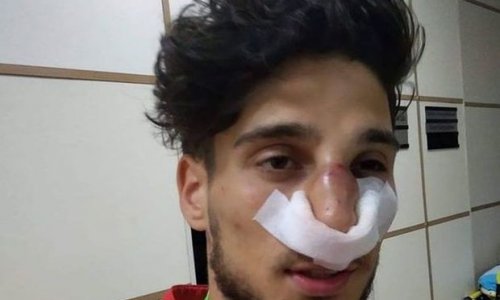 Mahir Mədətov qapıçının burnunu sındırdı - VİDEO
