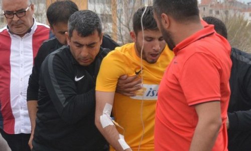 Futbolçunun ağzına arı girdi, xəstəxanalıq oldu - FOTO