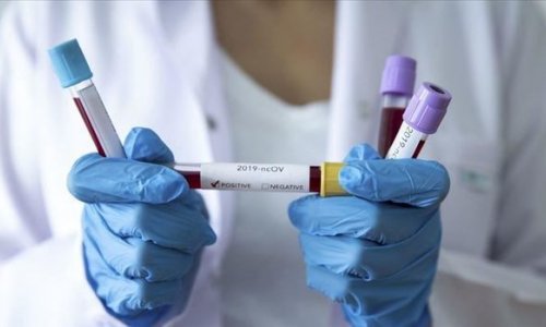 Azərbaycanda koronavirusdan daha bir nəfər öldü: 104 yeni yoluxma - RƏSMİ