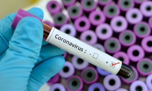 Koronavirusla bağlı son vəziyyət