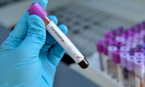В Азербайджане выявлено 40 новых случаев инфицирования COVİD-19