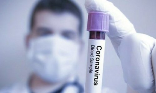 Türkiyə koronavirus daşıyıcılarını bu üsulla tapacaq