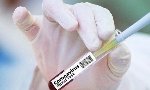 Azərbaycanda daha 67 nəfərdə koronavirus aşkarlandı - ÖLƏNLƏR VAR