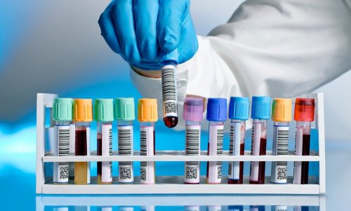 В Азербайджане проведено свыше 180 тыс. тестов на коронавирус