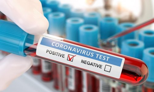 Azərbaycanda daha 113 nəfər koronavirusa yoluxdu, 55 nəfər sağaldı
