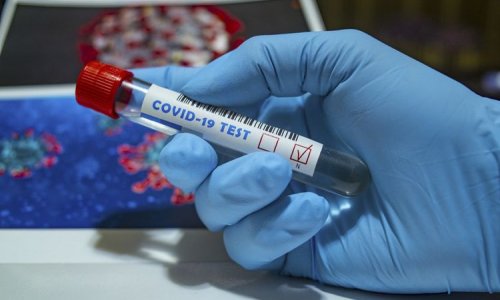 Azərbaycanda daha 106 nəfərdə koronavirus aşkarlandı