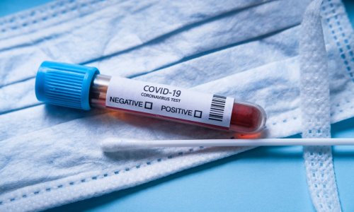 Daha 262 yeni nəfər koronavirusa yoluxub, 2 nəfər ölüb