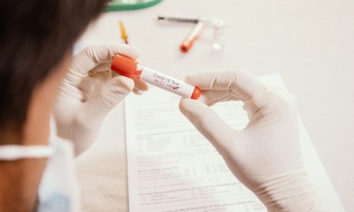 Azərbaycanda daha 352 nəfər koronavirusa yoluxdu, 6 nəfər öldü