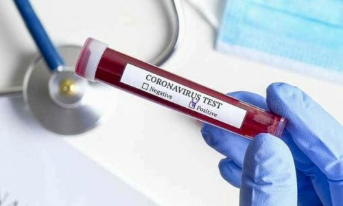 Evdə müalicə olunan koronavirus xəstələri üçün QAYDALAR açıqlanıb