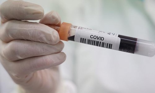 В США число заражений коронавирусом превысило 2,5 млн.