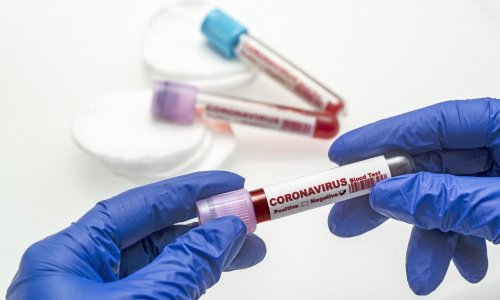 Ухудшится ли ситуация с коронавирусом осенью?