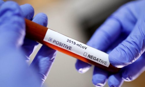 В Азербайджане выявлен 391 новый случай заражения коронавирусом, 504 выздоровели