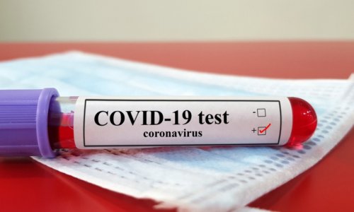 В Азербайджане 84 новых случая заражения коронавирусом