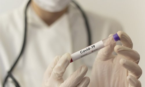 Daha 7 şagirddə koronavirus aşkarlanıb