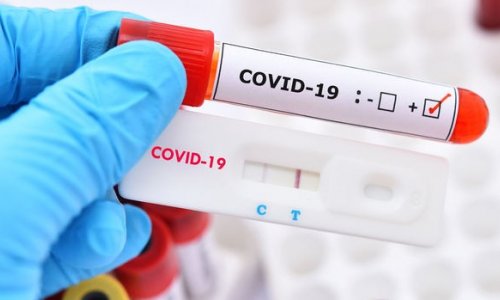 Azərbaycanda son sutka ərzində koronavirusa yoluxanların STATİSTİKASI
