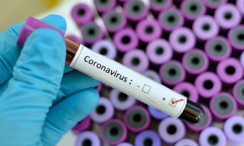 Azərbaycanda son sutka ərzində koronavirusa yoluxanların STATİSTİKASI