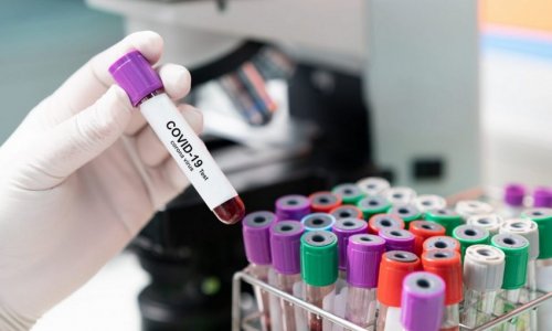 В Азербайджане коронавирусом заразились еще 339 человек