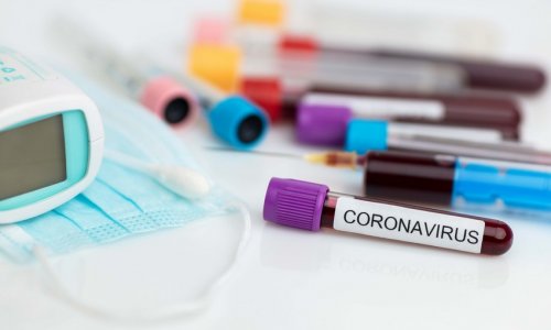 В Азербайджане число активных больных коронавирусом снизилось до 3 624