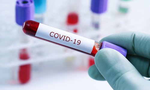 В Азербайджане за минувшие сутки выявлены 32 новых случая инфицирования коронавирусом 