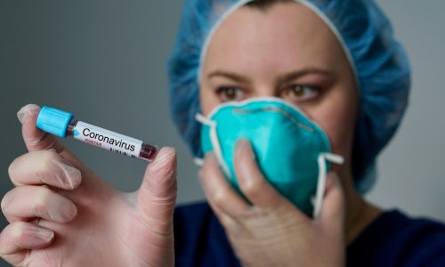 В Азербайджане за минувшие сутки выявлены 75 новых случаев инфицирования коронавирусом