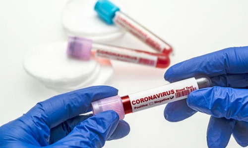 95 новых больных коронавирусом в Азербайджане