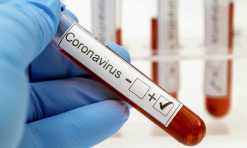Son sutkada Azərbaycanda koronavirusa yoluxanların STATİSTİKASI