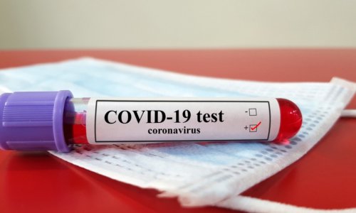 Azerbaijan confirms 865 new COVID-19 cases, 16 deaths