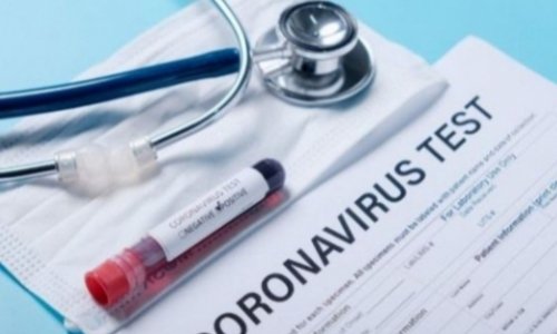 В Азербайджане за сутки выявлено 11 случаев заражения коронавирусом
