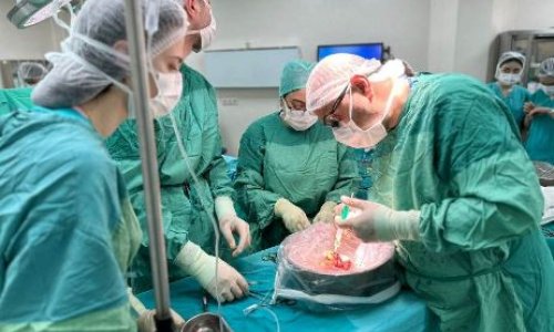 İcbari tibbi sığorta  son bir ildə 145 transplantasiya əməliyyatını  maliyyələşdirib