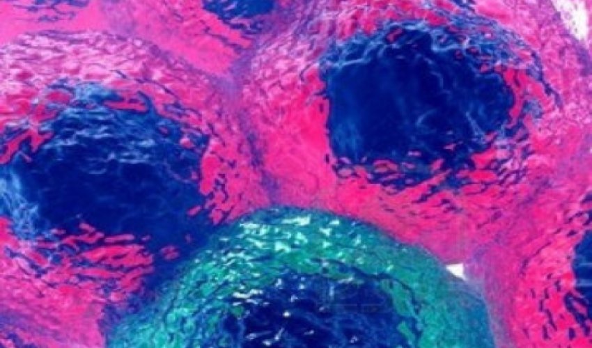 QİÇS xəstəliyinin müalicəsi tapıldı QİÇS xəstəliyinin müalicəsi tapıldı