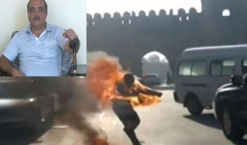 Özünü yandırmış Qarabağ qazisi vəfat etdi Özünü yandırmış Qarabağ qazisi vəfat etdi