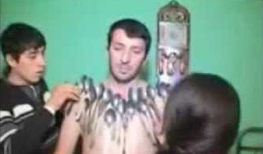 Daha bir həmyerlimiz “maqnit adam” oldu - VİDEO