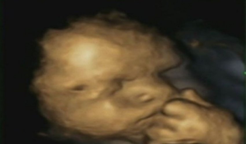 Is this picture proof that unborn babies feel mother's stress?