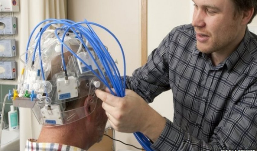 Microwave helmet 'can spot a stroke' Microwave helmet 'can spot a stroke'